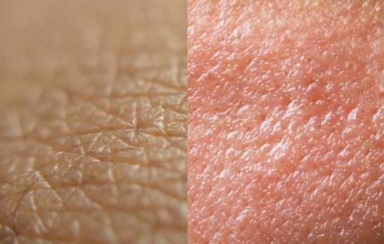 Hautpflege und Hautirritationen